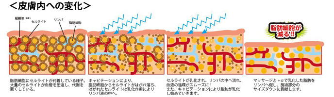 ＜皮膚内への変化＞